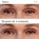 Glov - Parches de silicona antiarrugas y líneas finas - 49% OFF