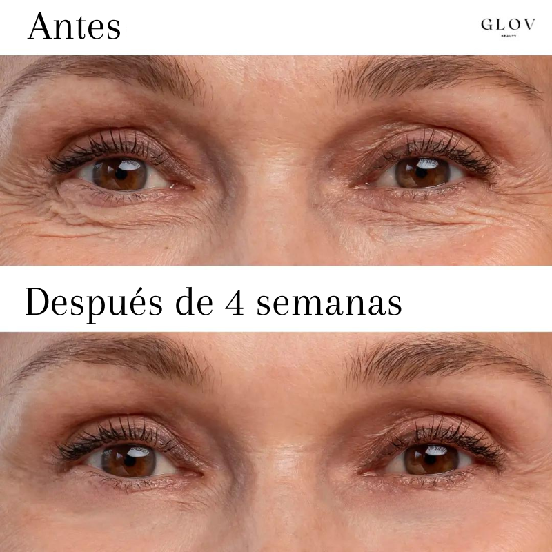 Glov - Parches de silicona antiarrugas y líneas finas - 49% OFF